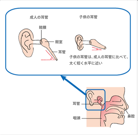 中耳炎 耳 オファー カバー